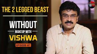 THE 2 LEGGED BEAST | Episode 07 | Without Makeup with Vishwa