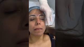 Signature Laser Facial - The results speak for itself!