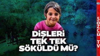 Narin Güran Olayında Korkunç İddia! Dişleri Tek Tek Çekilmiş Olabilir! Adli Tıp Uzmanı Açıkladı