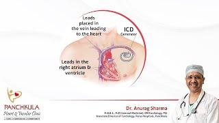 Introduction to ICD device | Dr. Anurag Sharma
