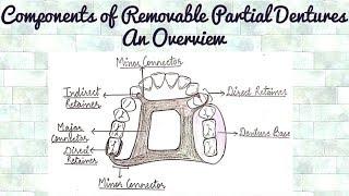 Components of Removable Partial Dentures - An Overview