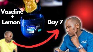 I Tried Vaseline and Lemon on My Face for 7 Days - The Results Were Amazing