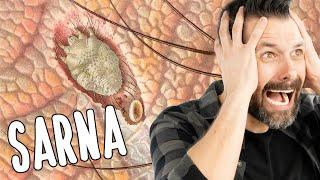 SARNA HUMANA - Escabiose - Uma coceira insuportável | Biologia com Samuel Cunha