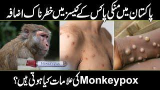 Alert ! Monkey pox Virus Spreading in Pakistan | Symptoms & Causes & Treatment