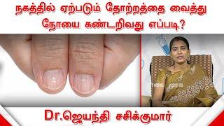 நகத்தில் ஏற்படும் தோற்றத்தை வைத்து நோயை கண்டறிவது எப்படி? | மருத்துவர் ஜெயந்தி சசிக்குமார்