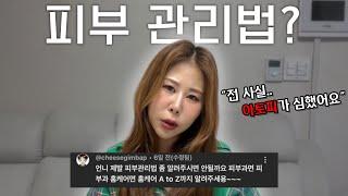 [Q&A] 얼마벌어요? 시술 뭐 받았어요? 멘탈관리는? 솔직히 말씀드릴게요