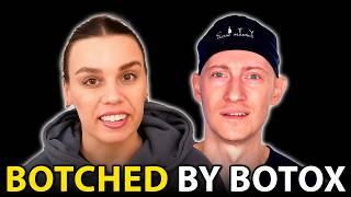 I Got BOTCHED By Botox | Plastic Surgeon Reacts
