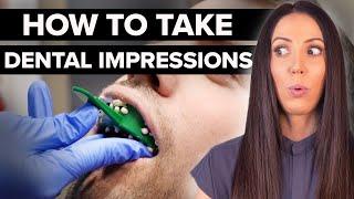 Surviving Dental Impressions (what to expect)