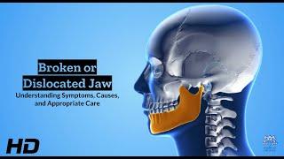 Broken or Dislocated Jaw: Mending the Misery