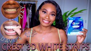 I Tried The Crest 3D White Strips for 24 Days! | Quick/Affordable Teeth Whitening | Before & After