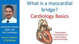 What is a myocardial bridge? Cardiology Basics