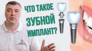 Нужно ли устанавливать зубной имплант? (Школа здоровых зубов)