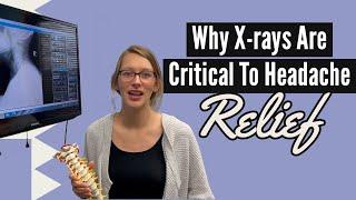 Why X-rays Are Critical To Headache Relief | Chiropractor for Headaches in Arlington Heights, IL