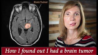 Brain Tumor Journey pt 1: From dizzy spells, headaches, vertigo, to diagnosis, Jodi Orgill Brown