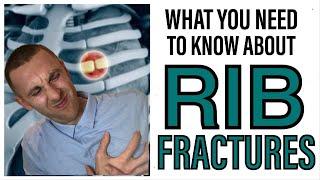 RIB FRACTURES: What To Know and What To Do | Aleks Physio