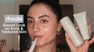 TESTING RHODE SKINCARE ON ACNE & TEXTURE | Hailey Bieber Glazed Donut Look on Imperfect Skin