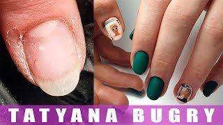 Оторванные Заусенцы/ Ногти Растущие ВВЕРХ/ Укрепление АкриГелем/ Татьяна Бугрий