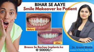 Smile Makeover for Patient from Bihar: Dr. Srishti Bhatia #smilemakeover #smile