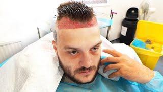 TGF DO IT #6 - Hairline Surgery Edition