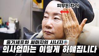 레이져에 반응 안하는 기미와 모공 뽀얗고 하얗게 주름 없는 피부 만들기(당일에도 티가 안나요)