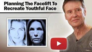 Female Facelift - Planning The Facelift To Recreate The Youthful Face - Dr. Gerald O'Daniel