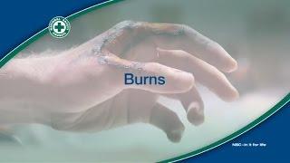 Treatment of burns
