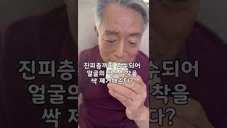 피부가 이렇게 깔끔해진다고??? #기미잡티크림 #검버섯크림 #주근깨크림