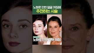 노화로 인한 얼굴꺼짐에 추천하는 시술 #shorts