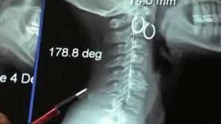High Blood Pressure the Common Sense Solution
