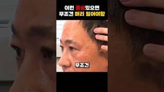 이런 증상 있다면 무조건 삭발해야합니다