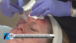 SLUCare Refresh and Reveal shows the positive results of microneedling