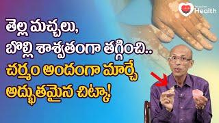 Bolli, Vitiligo | తెల్ల మచ్చలు బొల్లి శాశ్వతంగా తగ్గించే! Dr. Ch Madhusudana Sarma | TeluguOneHealth