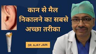 Ear wax removal | Best method | In Hindi | Dr Ajay Jain