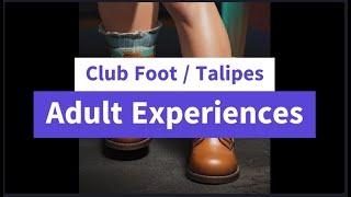 Adults who have, or do, experience symptoms associated with their childhood Clubfoot.