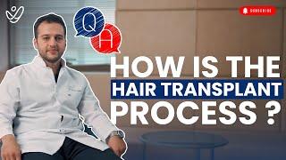 How is the Hair Transplant Process?