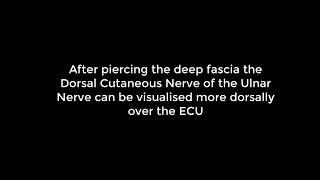 Ultrasound of the Dorsal cutaneous branch of the ulnar nerve.