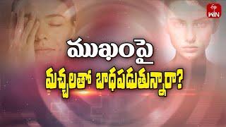 Remedies for black spots on Face | Sukhibhava | 7th Dec 2024 | ETV Life