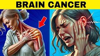 8 WEIRD SIGNS of BRAIN CANCER (Discover Them BEFORE It’s Too Late!)