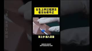 上环过程，看完真的心疼她 #女性健康 #上环 #情侣 #关爱女性健康 #硬核健康科普行动