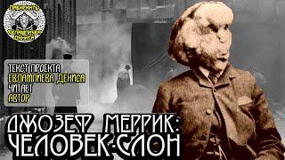 Джозеф Меррик: Человек-слон I текст Евлампиева Дениса читает автор