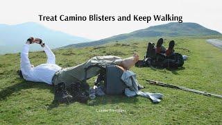 Treat CAMINO Blisters and KEEP WALKING