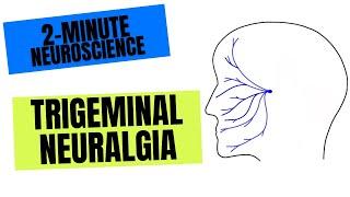 2-Minute Neuroscience: Trigeminal Neuralgia