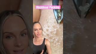 MOST SATISFYING BLACKHEAD PLUCKING REMOVAL #shorts