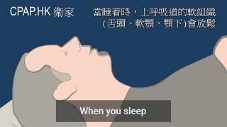 為何會打鼻鼾? 什麽是睡眠窒息症? 睡眠呼吸機是什麼? 歡迎聯絡CPAP.HK衛家睡眠呼吸機專門店讓我們為您詳細講解及免費提供建議。電話 Tel: 6645 8282