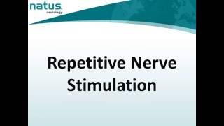 17. UltraPro First Generation Hardware - Repetitive Nerve Stimulation