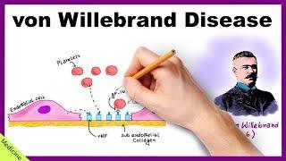 VON WILLEBRAND DISEASE: Pathophysiology, Clinical Findings, Diagnosis, Treatment