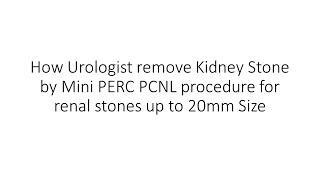 How Urologist remove Kidney Stone by Mini PERC PCNL procedure for renal stones up to 20mm Size