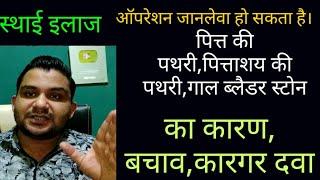 पित्ताशय की पथरी,पित्ते की पथरी,गॉल ब्लैडर स्टोन में क्या करें?क्या न करें?सटीक जानकारी|सटीक इलाज|