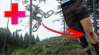 HORROR CRASH an den Wexl Trails 