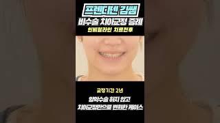 3급 부정교합 아래턱 돌출입 치아교정 전후 2년 (ft.인비절라인)